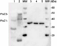 FtsZ1 and 2 | Plant cell division protein FtsZ1 and FtsZ2 in the group Antibodies Plant/Algal / Plant Developmental Biology / Cytoskeleton at Agrisera AB (Antibodies for research) (AS09 413)